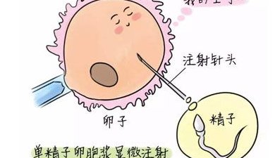 试管备孕期间为什么要多运动？