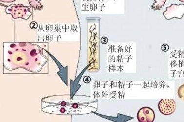 2026年想去临夏市做试管婴儿需要准备哪些事？详细收费明细一览